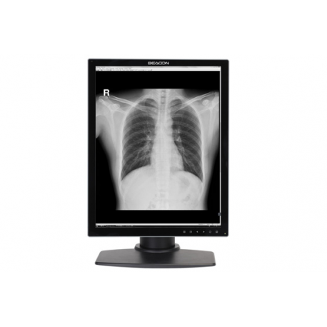 MONITOR MEDICAL COLOR DEDICAT PENTRU STUDII CLINICE BEACON G32S+