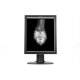 MONITOR MEDICAL MONOCROM RADIOLOGIC PENTRU DIAGNOSTIC MAMOGRAFIE BEACON G52SP+