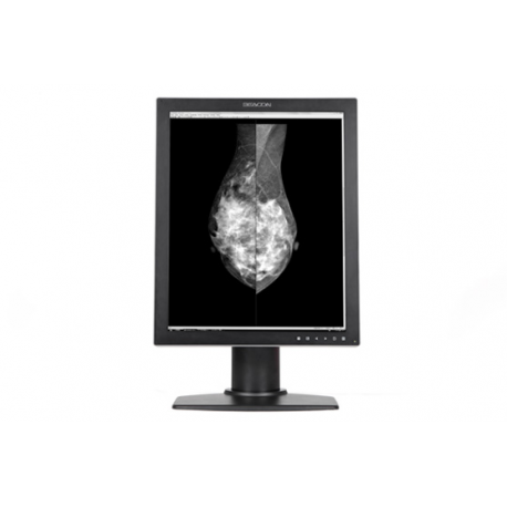 MONITOR MEDICAL MONOCROM RADIOLOGIC PENTRU DIAGNOSTIC MAMOGRAFIE BEACON G52SP+